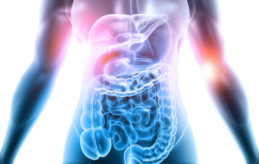 media.IG IBD congresso per malattie intestinali